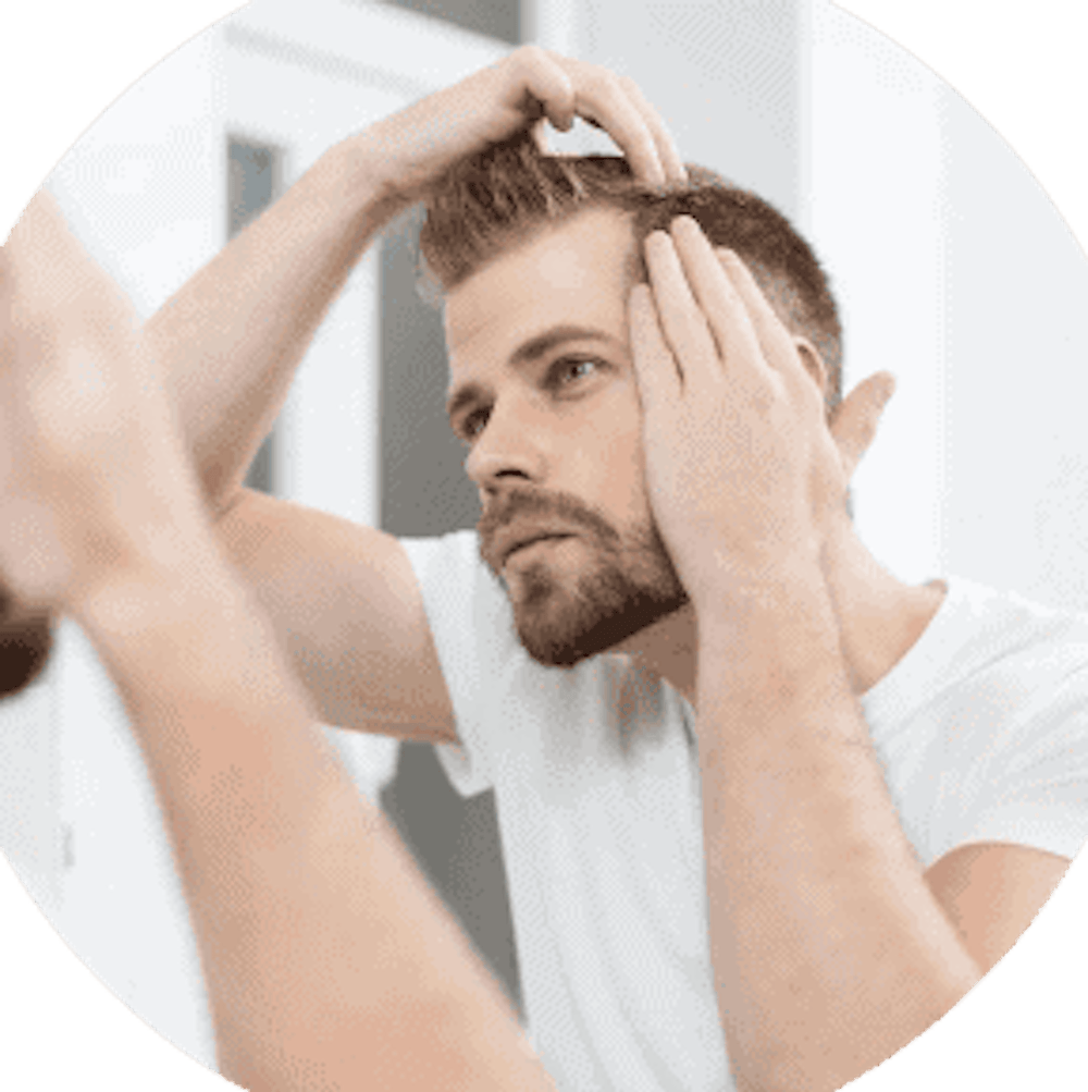 man standing in a mirror examining his hairline 768x768.jpg.webp
