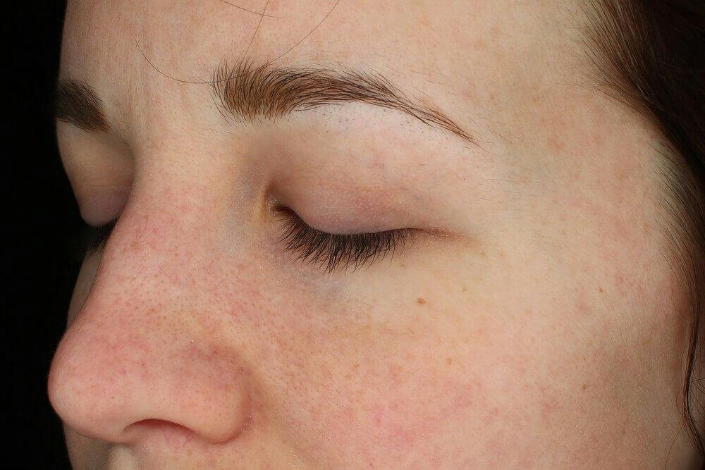 Latisse: Going Further Than Lashes 1 img