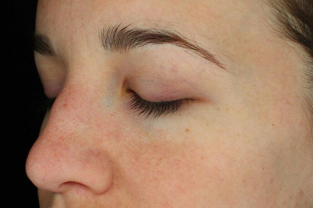 Latisse: Going Further Than Lashes 2 img 1