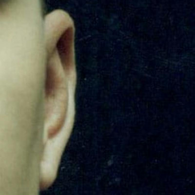 Ear Reshaping Before & After Gallery - Patient 262272 - Image 2