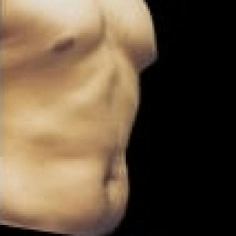 SAFElipo Before & After Gallery - Patient 138305 - Image 1