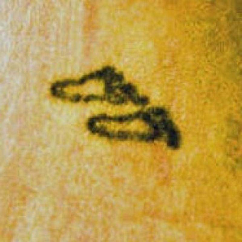 Laser Skin Treatments Before & After Gallery - Patient 195935 - Image 1
