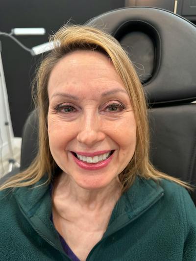 BOTOX Before & After Gallery - Patient 169979 - Image 1