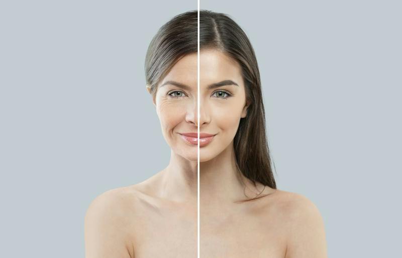Young/old comparison of woman's face