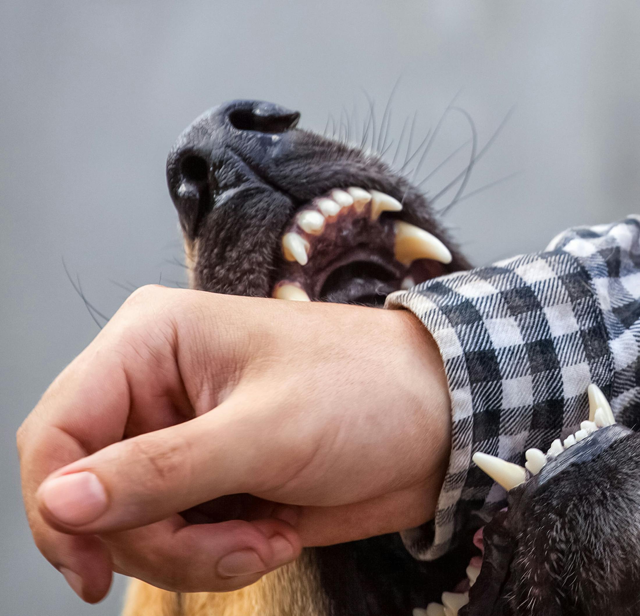 dog biting a persons arm
