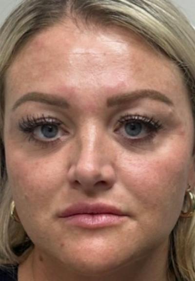 Results Before & After Gallery - Patient 289909 - Image 1