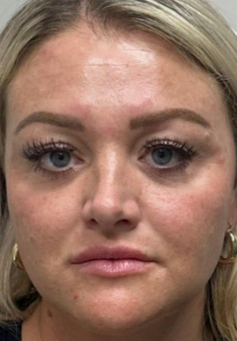 Results Before & After Gallery - Patient 289909 - Image 1