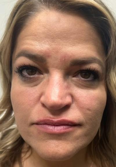 Results Before & After Gallery - Patient 184650 - Image 1