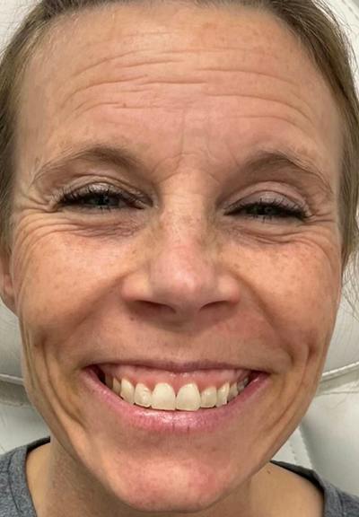 Results Before & After Gallery - Patient 194251 - Image 1