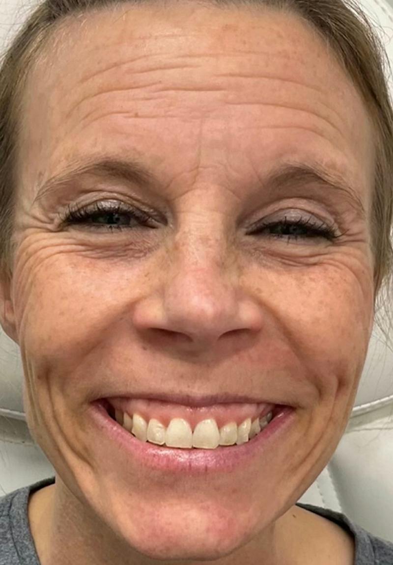 Results Before & After Gallery - Patient 194251 - Image 1