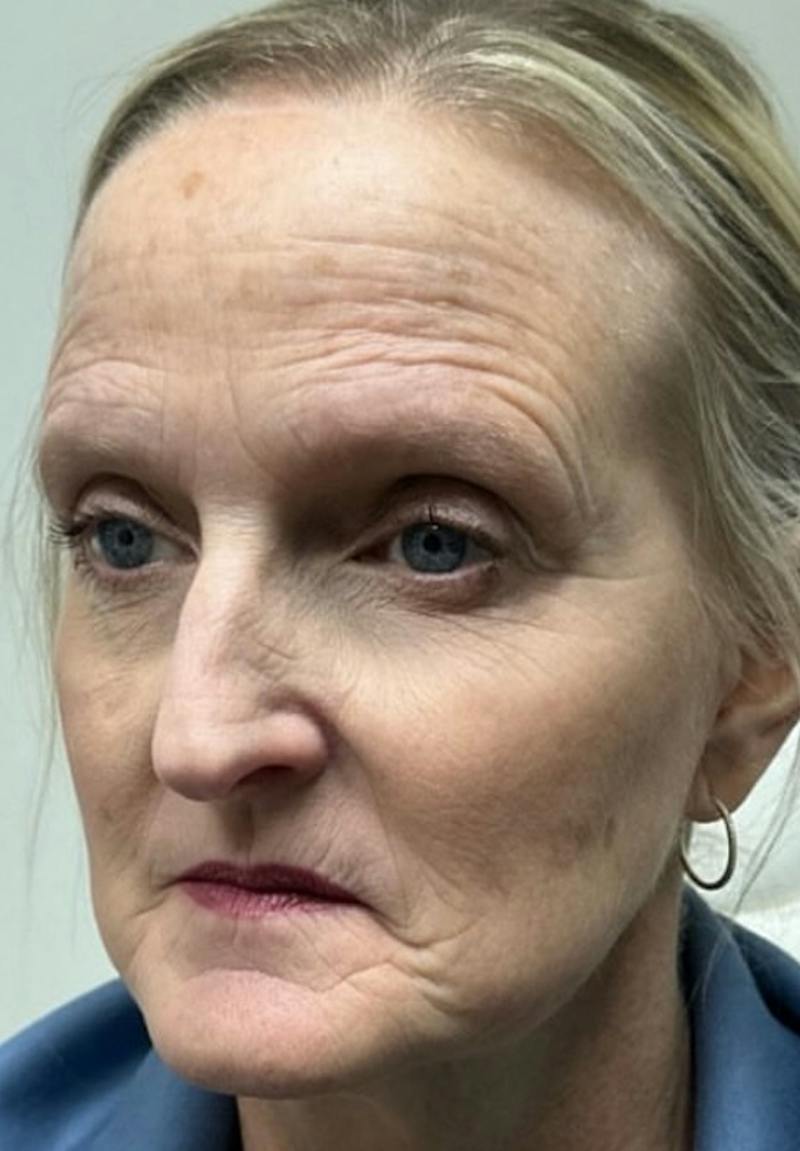 Results Before & After Gallery - Patient 686963 - Image 1