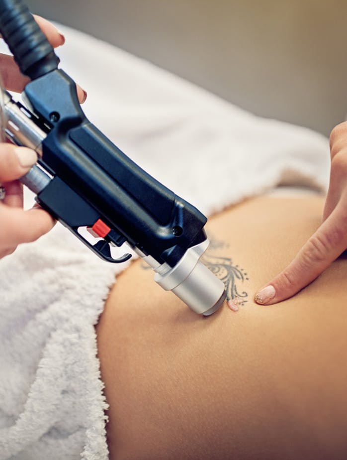 Tattoo Removal Boulder - Tattoo Removal Boulder Ink Revoke Boulder S Original Laser Experts : Serving boulder, longmont, loveland, fort collins, greeley and northern colorado colorado laser treatments 1361 francis st.