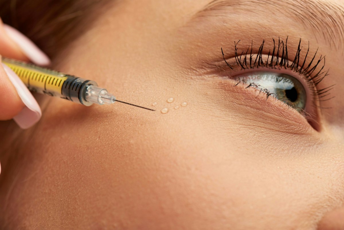 Patient receiving Botox injection near the eye at Geneva Med Spa to treat persistent eye twitching and facial muscle spasms