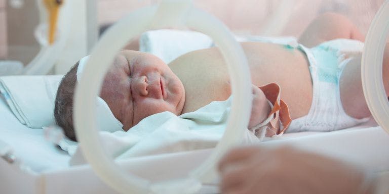 A newborn baby receiving neonatal care on a NICU ward