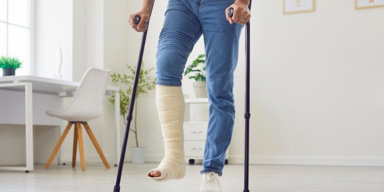 Managing long-term sickness absence Man with a broken leg on long-term sick leave