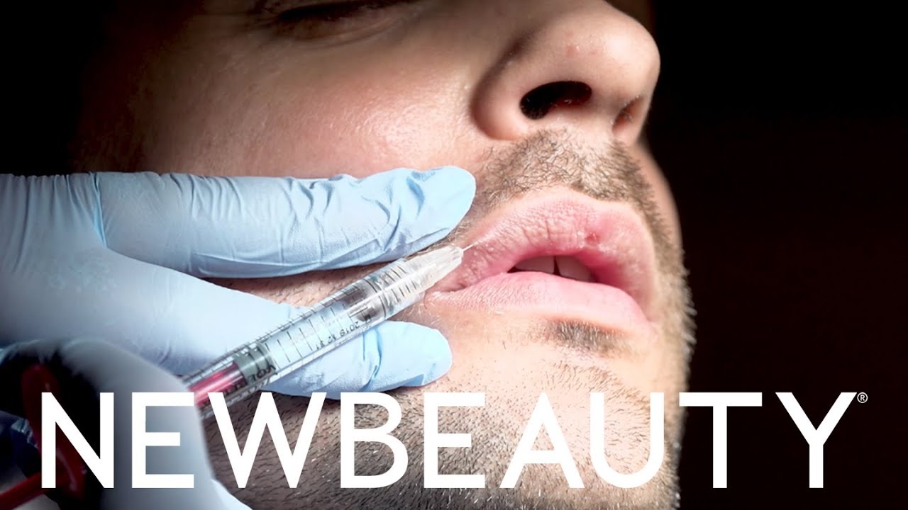 Man getting an injection into his lip.