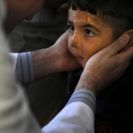 Person holding a child's disfigured face in their hands.