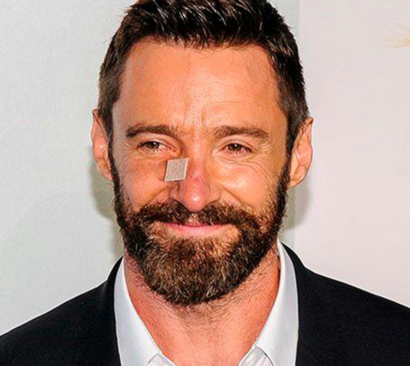 Photo of actor, Hugh Jackman, with a bandaid on his nose after being treated for skin cancer.