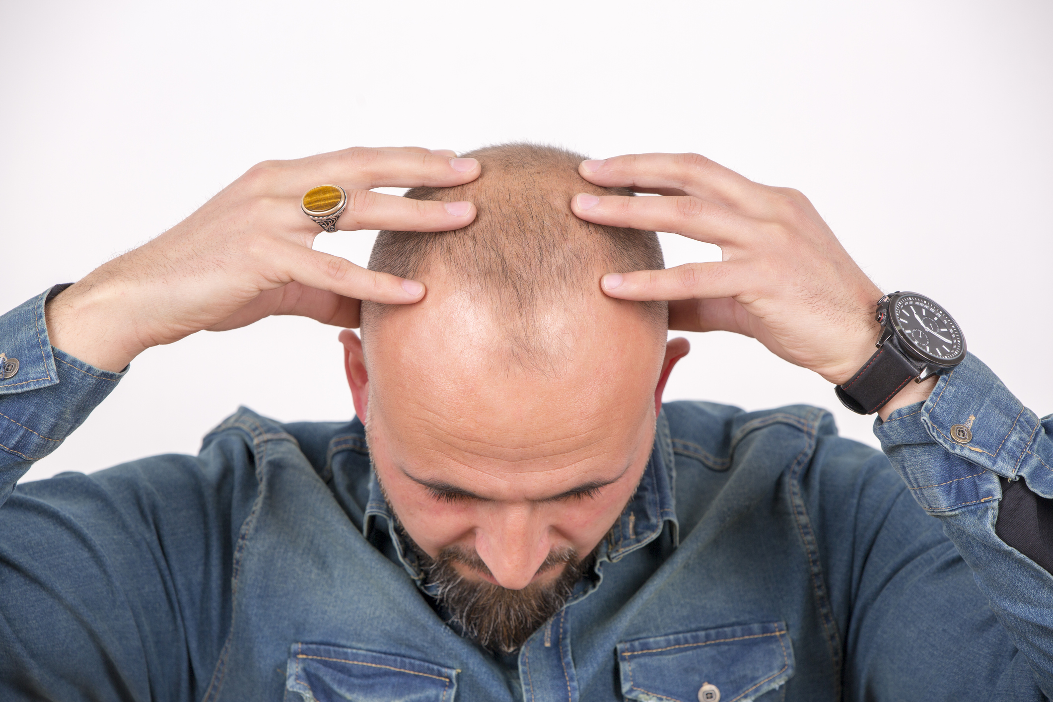 Man with his hands on his head.