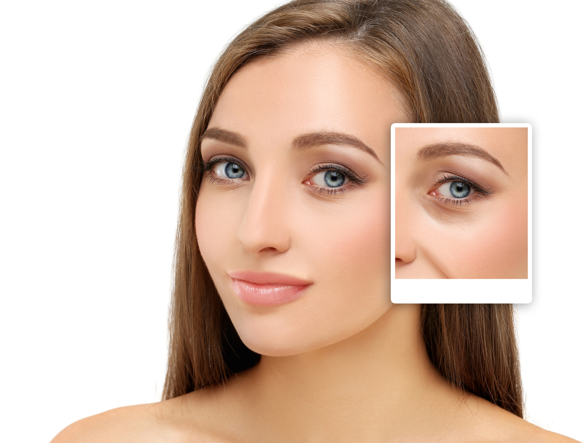 What Potential Side Effects Will I Experience After Blepharoplasty