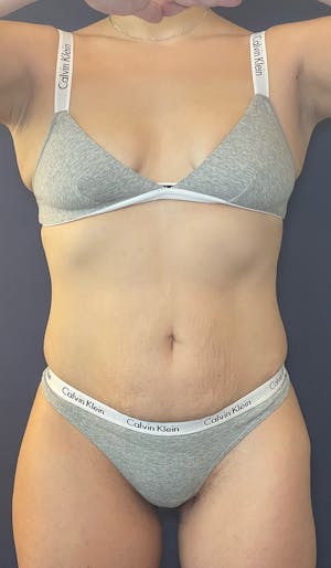 Before and after photo