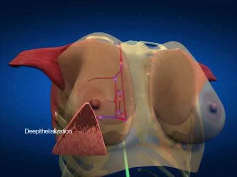 3d image of chest cavity
