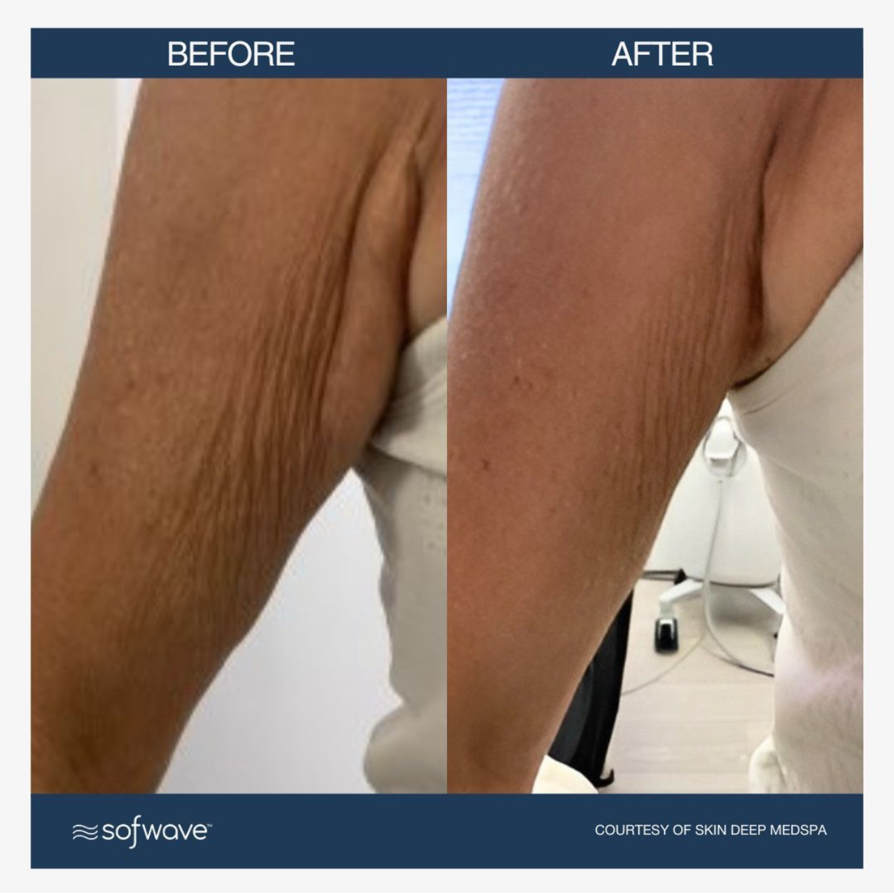 before and after photo