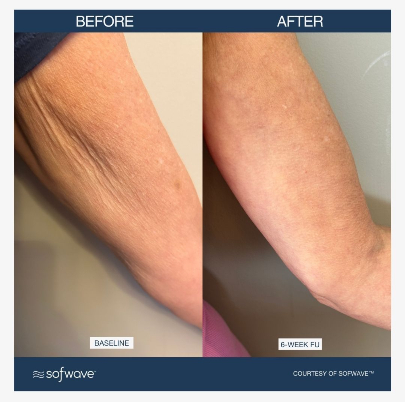 before and after photo