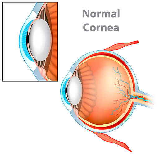 Normal Cornea medical illustration