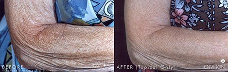 Results from the Environ Body Range collection of products