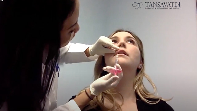 Woman About to Get a Dermal Filler Injection