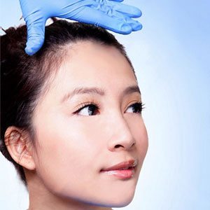 asian-eyelid-surgery-in-westake-village-ca