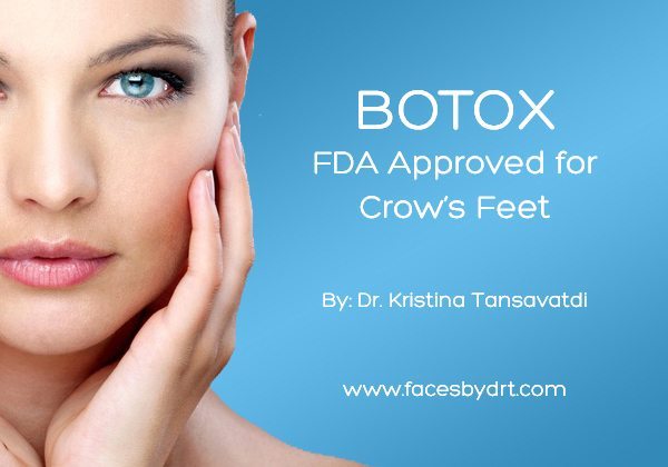 BOTOX: FDA Approved for Crow’s Feet. Tansavatdi Cosmetic & Reconstructive Surgery 696 Hampshire Road, Suite 170 Westlake Village, CA 91361 (805) 715-4996