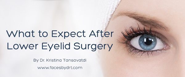 What to Expect After Lower Eyelid Surgery