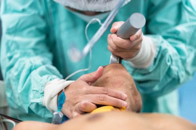 Airway Management: Nozioni, Procedure e Strategie sulla Gestione Avanzata delle Vie Aeree