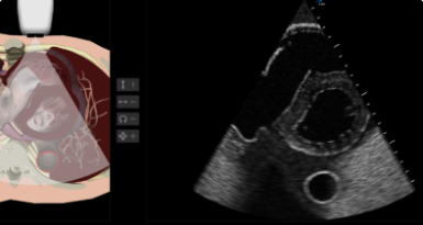 Ultrasound and Diagnostics