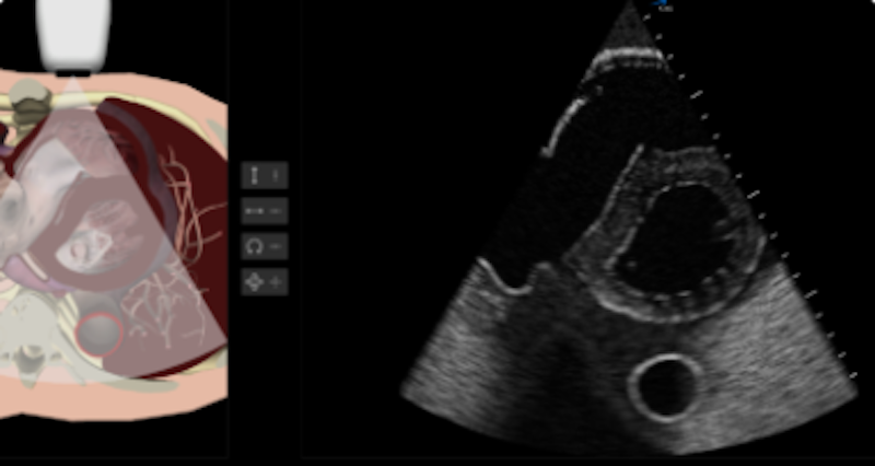 Ultrasound and Diagnostics