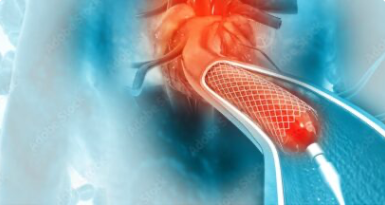 Vascular Surgery