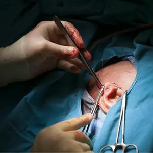 doctor performing surgery