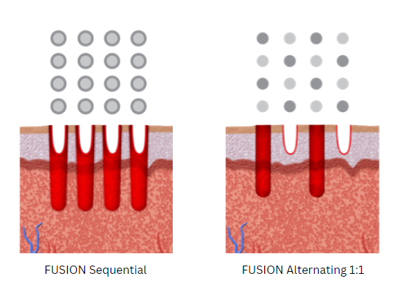 Fusion infographic