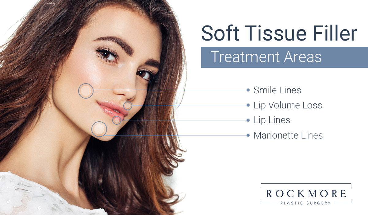 Soft Tissue Filler infographic