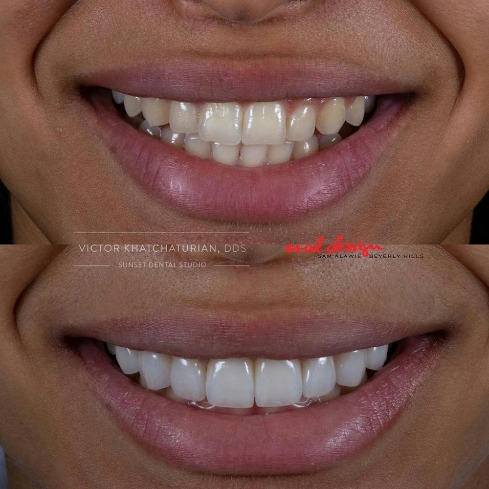 Gallery Before & After Gallery - Patient 4387399 - Image 1
