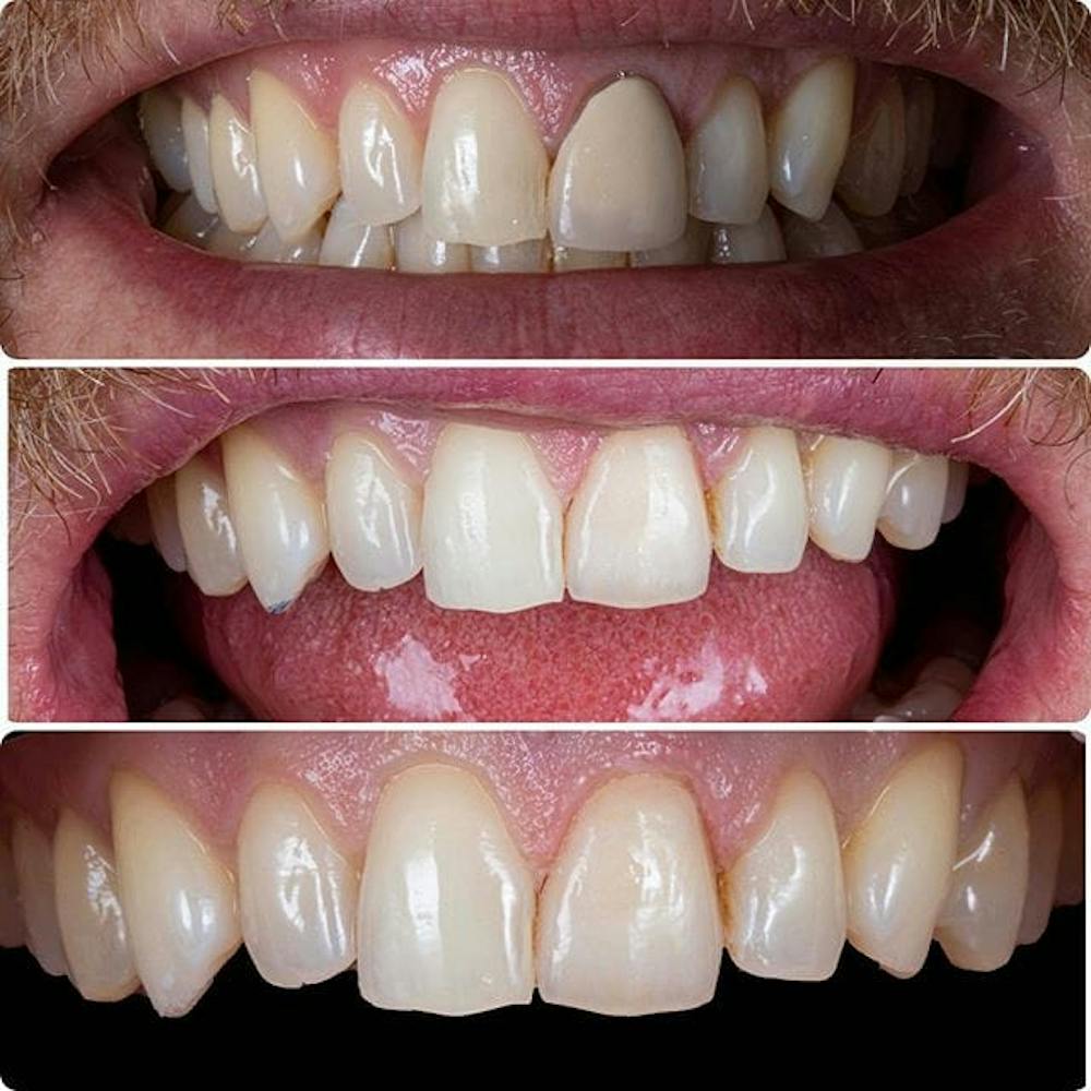 Gallery Before & After Gallery - Patient 4387404 - Image 1