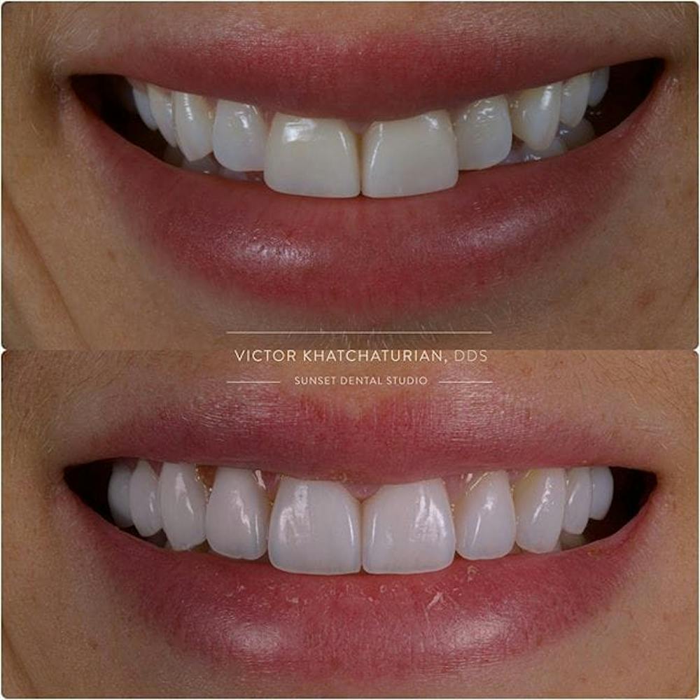 Gallery Before & After Gallery - Patient 4387405 - Image 1