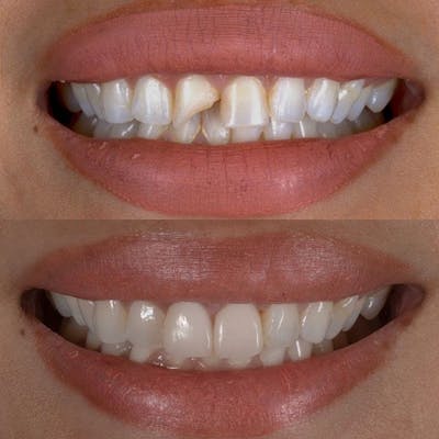 Gallery Before & After Gallery - Patient 4387406 - Image 1