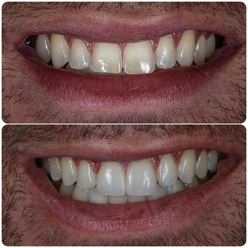 Gallery Before & After Gallery - Patient 4387407 - Image 1