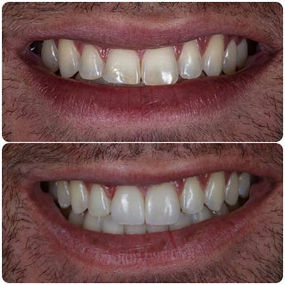 Gallery Before & After Gallery - Patient 4387407 - Image 1