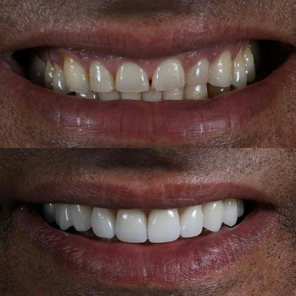 Gallery Before & After Gallery - Patient 4387410 - Image 1