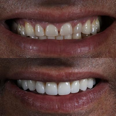 Gallery Before & After Gallery - Patient 4387410 - Image 1