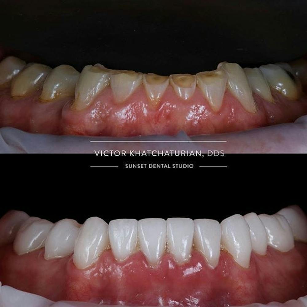 Gallery Before & After Gallery - Patient 4387411 - Image 1